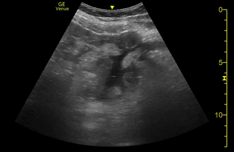 case study on ultrasound