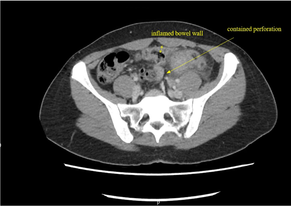 case study on ultrasound