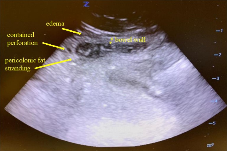 case study on ultrasound