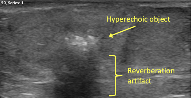 case study on ultrasound